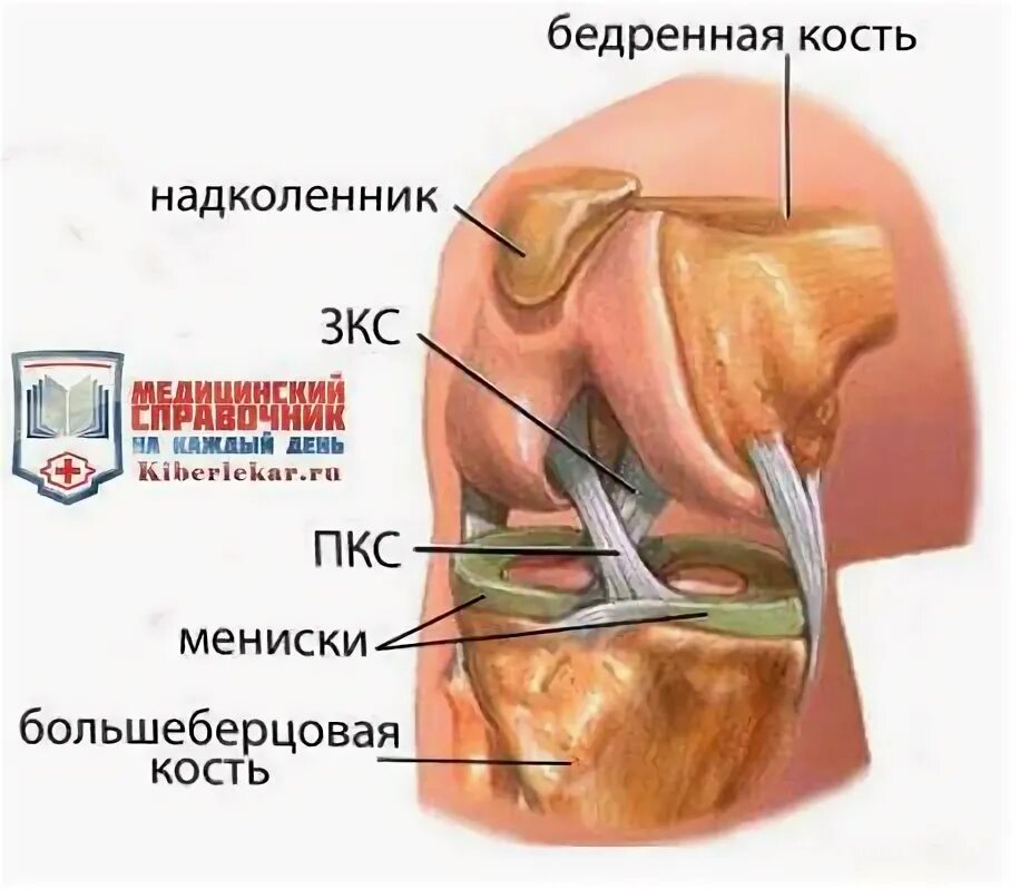 Разрыв мениска коленного лечение без операции. Резекция медиального мениска коленного сустава. мениск в начальной стадии. резекция заднего рога медиального мениска.