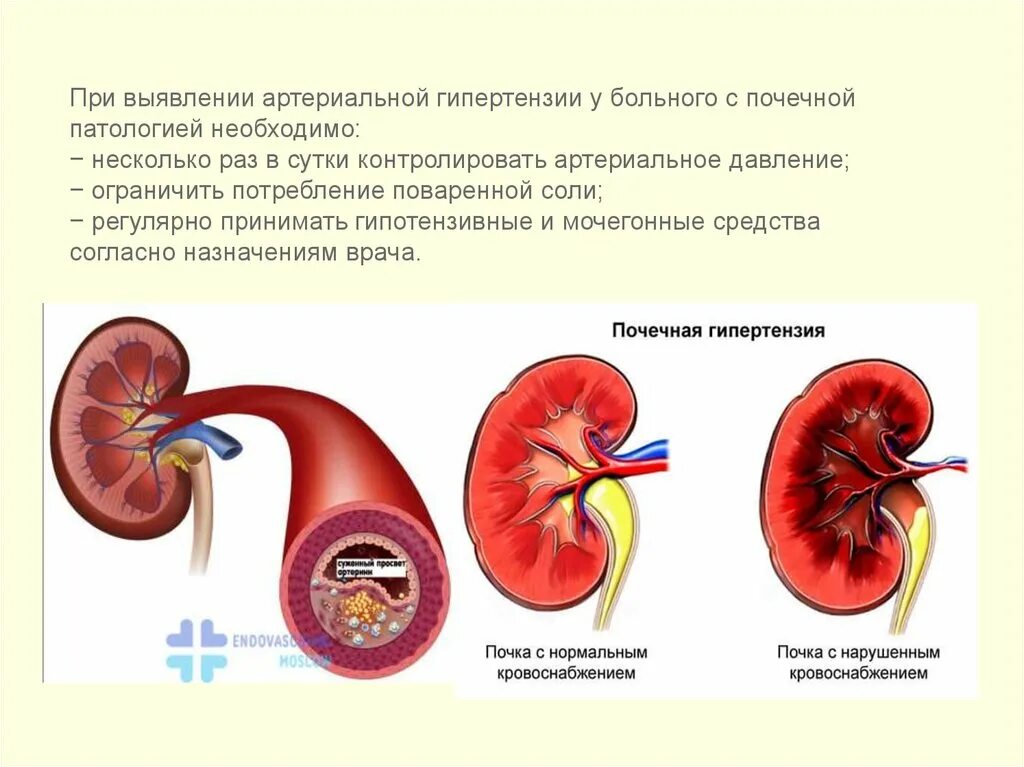 Влияние печени на почки. Влияние курения на мочевыделительную систему. Влияние табака на выделительную систему. Влияние сигарет на мочеполовую систему.