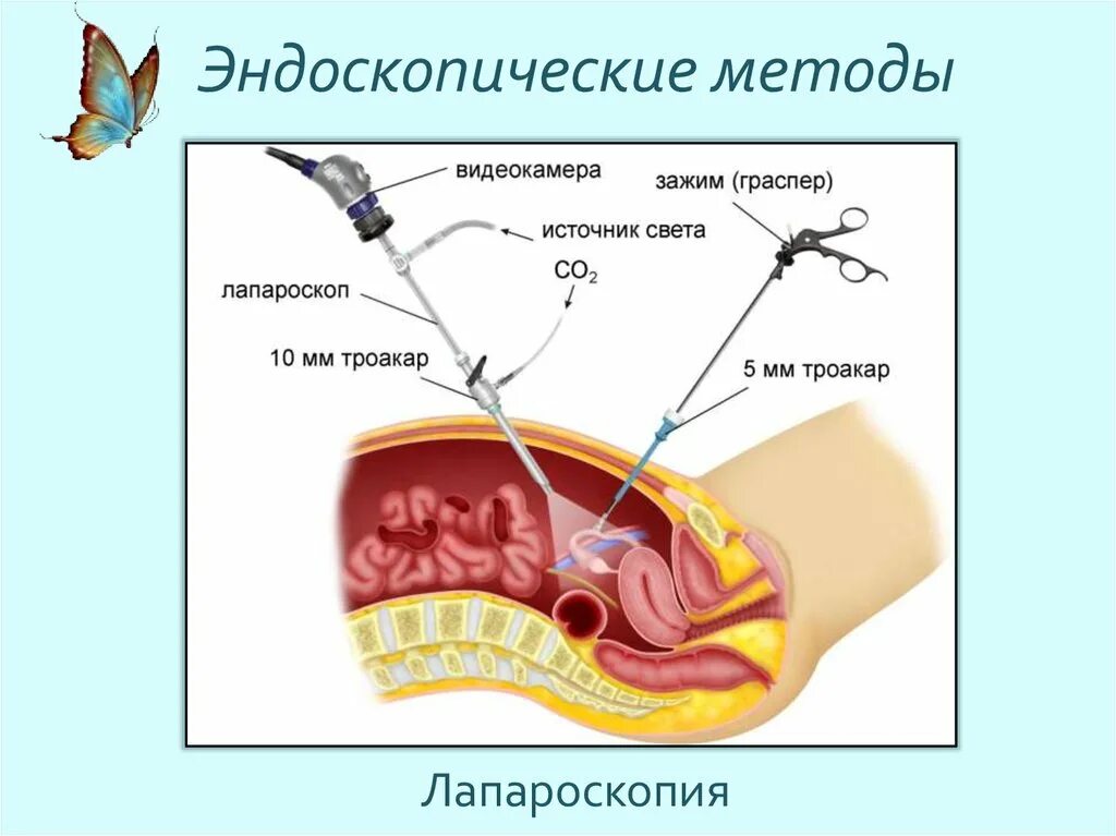 Эндоскопические методы. Эндоскопический метод исследования. Лапароскоп строение. Метод эндоскопии