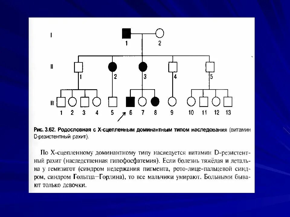 Рецессивно доминантный тип наследования. Х сцепленный доминантный Тип наследования. Родословная с x-доминантным типом наследования. X сцепленный доминантный Тип наследования родословная. Критерии х сцепленного доминантного типа наследования.
