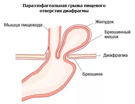 Упражнения для пищевода