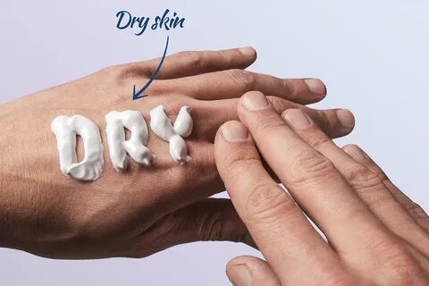 Синоним сухие руки
