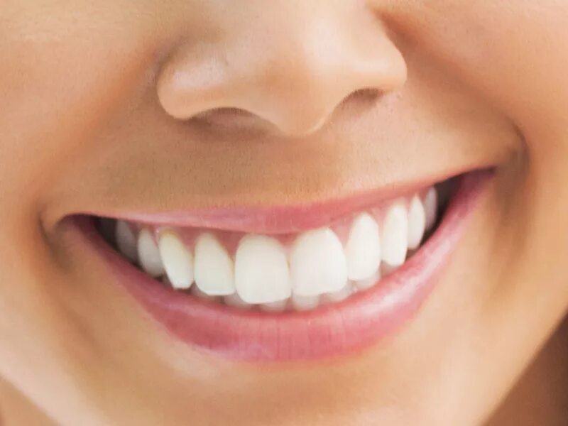 Улыбки какое число. Красивые зубы. Красивые ровные зубы. Красивая улыбка зубы. Белоснежные зубы.