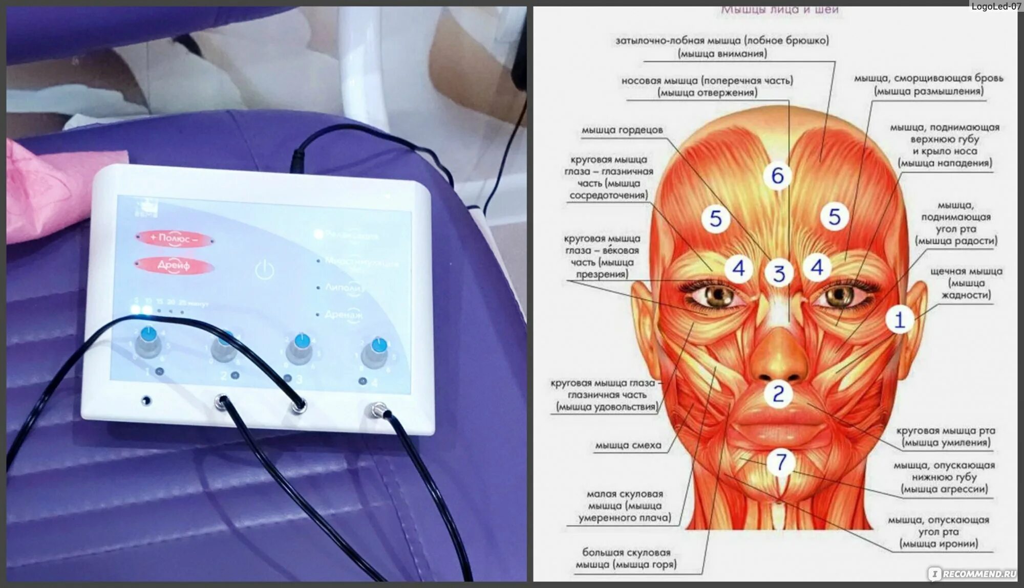 Электростимуляция мышц/электростимуляция мышц лица. Электростимуляция. Стимуляция мышц лица. Аппарат электромиостимуляции для лица. Миостимуляция в косметологии.