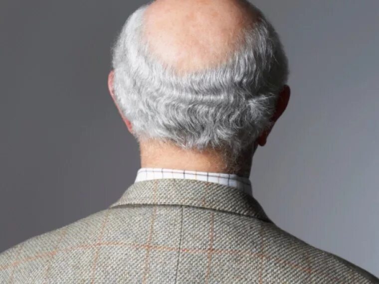 старый лысый седой. седая лысина. седая лысина. поседел. лысый с бородой стиль.