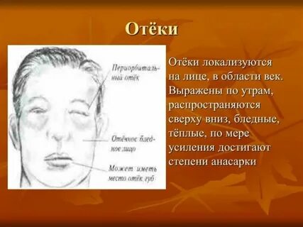 Почечное лицо