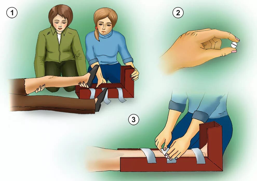 1 помощь при закрытых повреждениях. Открытый перелом кости первая помощь. Перелом и оказание первой медицинской помощи при переломе. Оказание первой помощи при ТПЕРЕЛОМ. Оказание первой помощи при переломах конечностей.