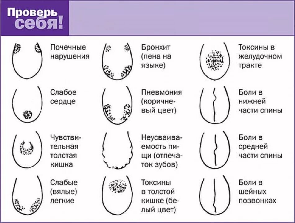 Язык человека определить болезнь. Болезни по языку определить. Диагностика по языку человека. Заболевание по цвету языка у человека.