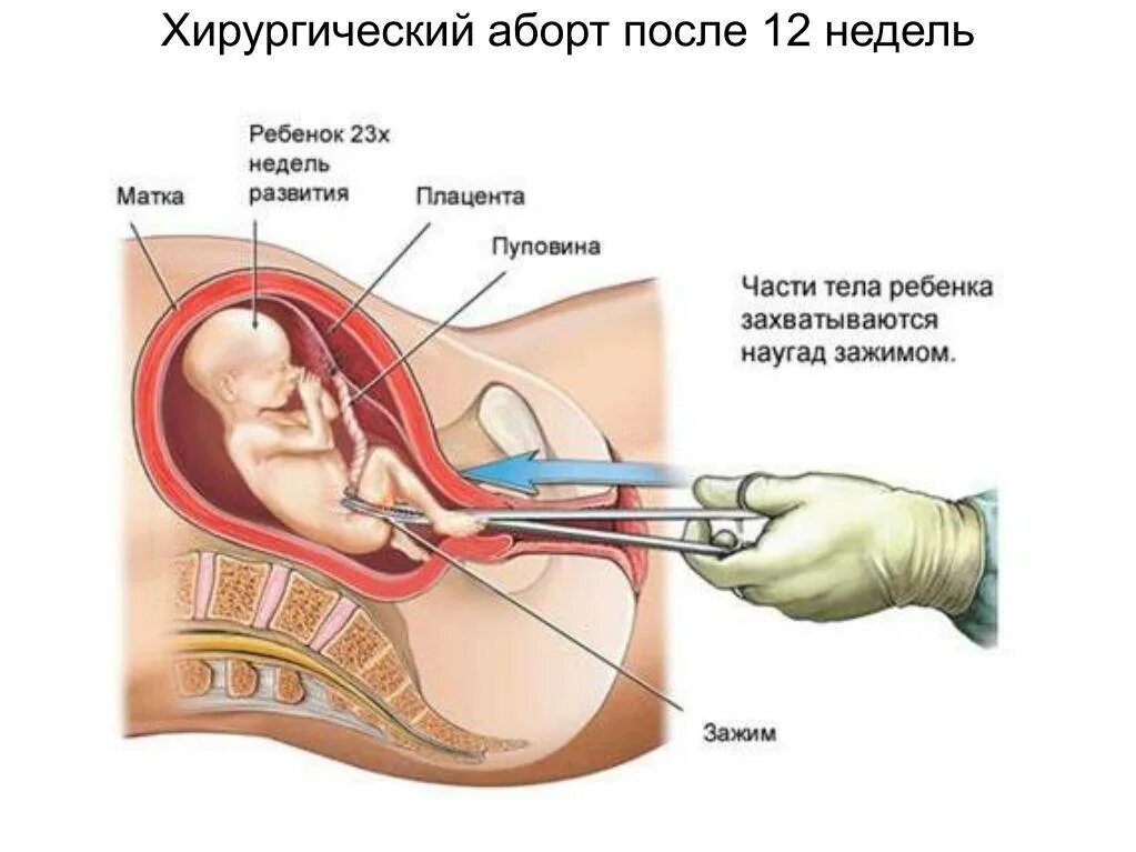 Интервал между прививками. Через сколько делают вторую. Календарь прививок для собак мелких пород с рождения. Прививки расшифровка корь. Через сколько делают вторую.