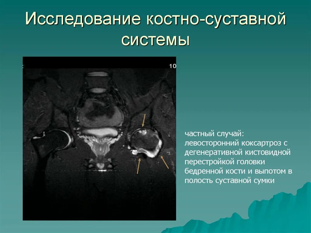 Методы исследования костной системы. Исследование костно-суставной системы. методы исследования костно-суставной системы. обследование костно суставной системы. рентген костно суставной системы.