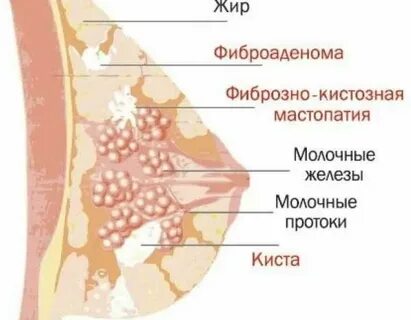 Что означает фиброзная ткань