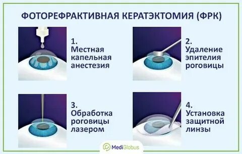 Фрк коррекция