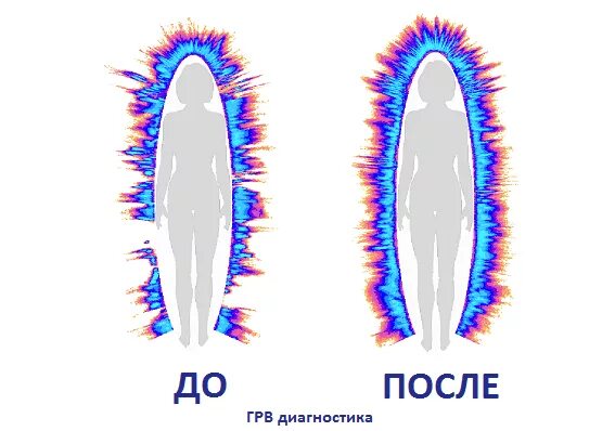 Газоразрядная визуализация