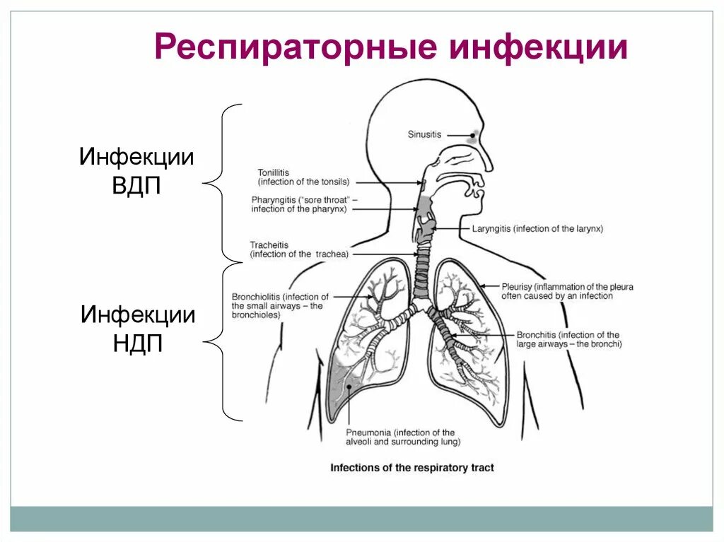 Тест заболевания верхних дыхательных путей. Заболевания верхних и нижних дыхательных путей. Дыхательные заболевания презентация. Острые заболевания верхних и нижних дыхательных путей у детей. Заболевания верхних дыхательных путей у детей.