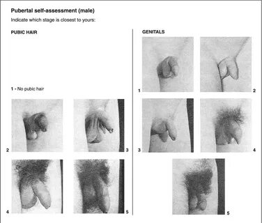 Figure 2 from Comparison between objective assessment and self-assessment of sex