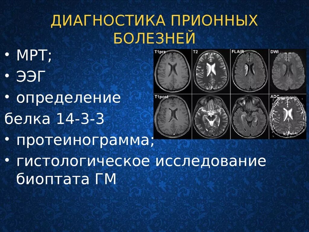 Прионные болезни это. Прионы и прионовые заболевания человека. Прионовые инфекционные заболевания. Болезни вызываемые прионами лабораторная диагностика.