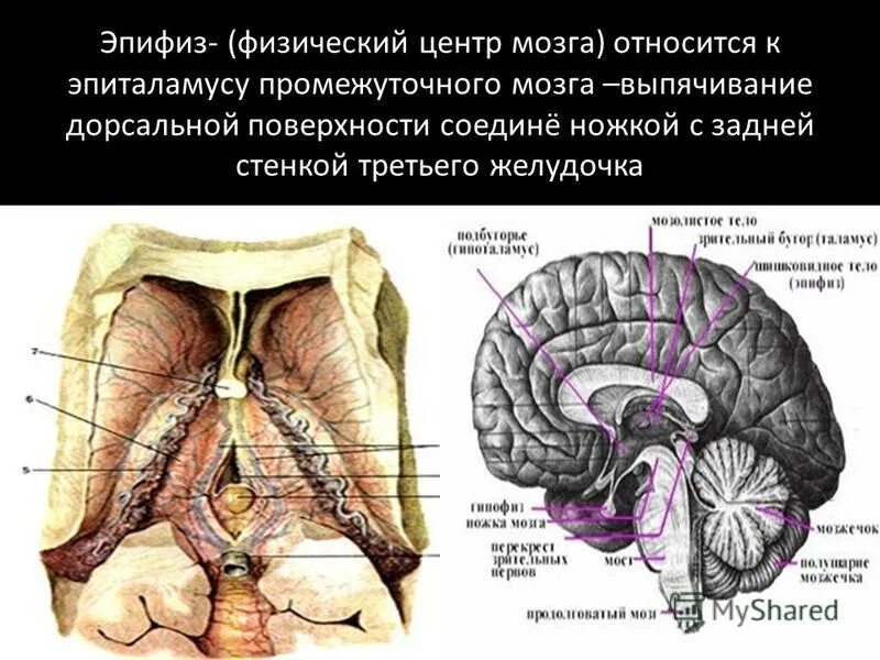 Шишковидная железа