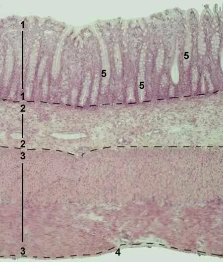 Ткани толстой кишки. Двенадцатиперстная кишка гистология. Слизистая ДПК гистология. Тонкая кишка гистология препарат. Оболочки толстой кишки гистология.