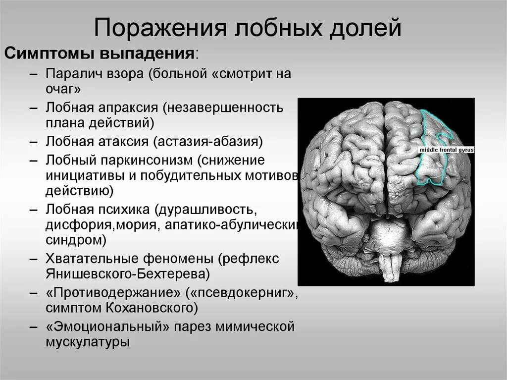 Органические изменения головного мозга. Синдром поражения лобной доли головного мозга. Синдромы поражения Лобн.Ой Лоди. Повреждение лобной доли симптомы.