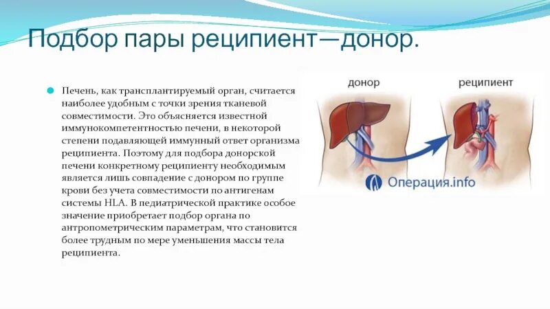 Критерии трансплантации печени. Трансплантация печени топографическая анатомия. Трансплантация печени основные этапы. Можно ли пересадить печень