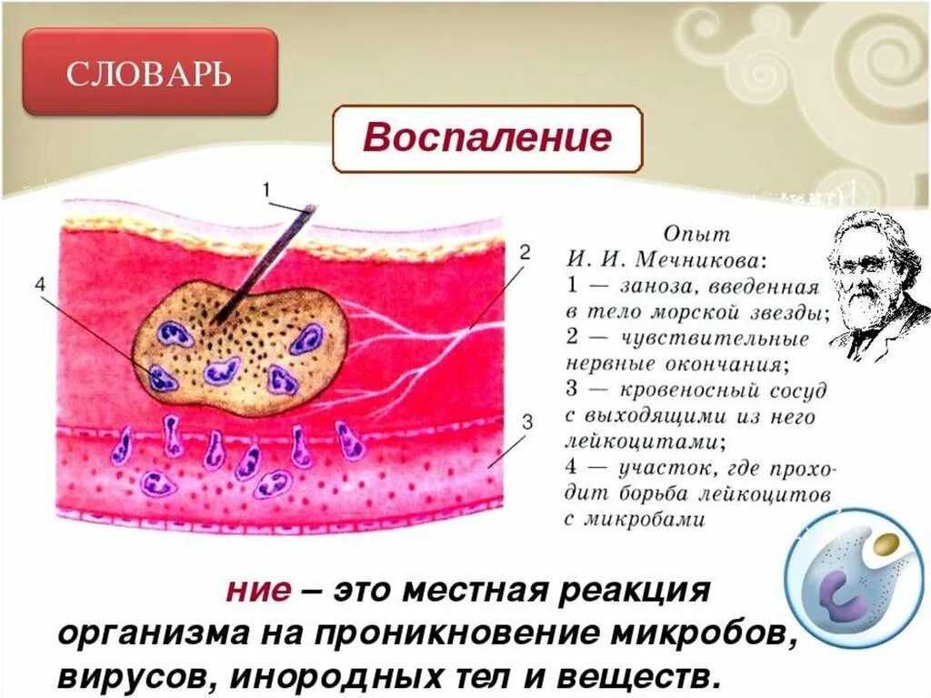 Воспалительный процесс в организме. Воспалительная реакция. Схема воспалительного процесса. Почему появляются воспаления