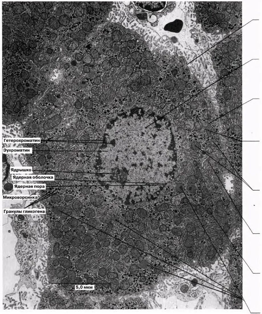 Клетки печени крыс. Микрофотография клетка печени крысы. Электронной микрофотографии клетки печени:. Строение ядра эухроматин гетерохроматин. Ядро клетки микрофотография.