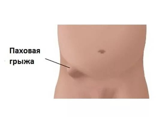 Что находится в паху у женщин