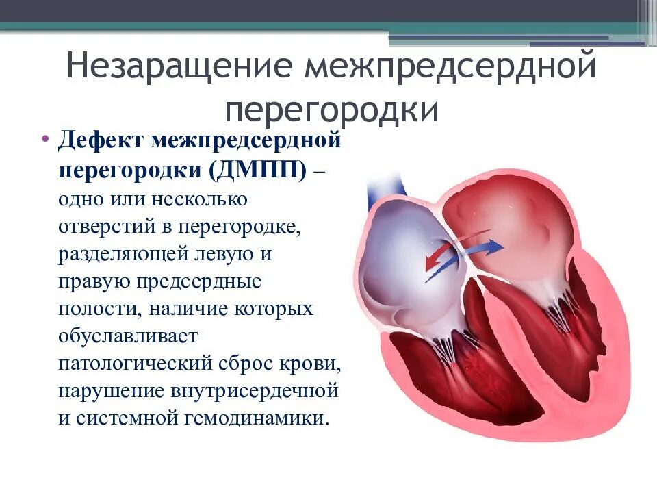 Функционирующее овальное. ВПС межпредсердной перегородки. ВПС дефект межпредсердной перегородки. Аневризма межпредсердной перегородки 8 мм.