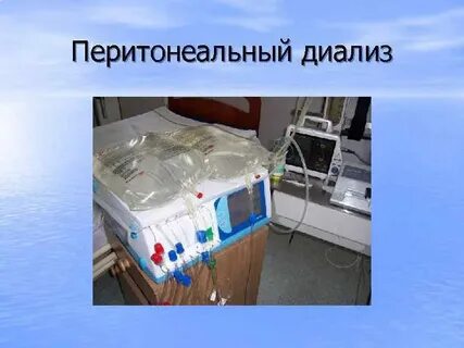 Перитонеальный диализ