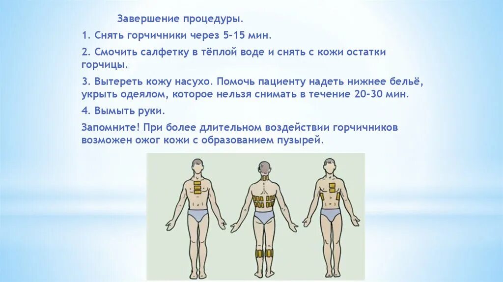 Методы простейшей физиотерапии горчичники. Схема постановки горчичников. Куда ставить горчичники. Физиотерапия горчичники.