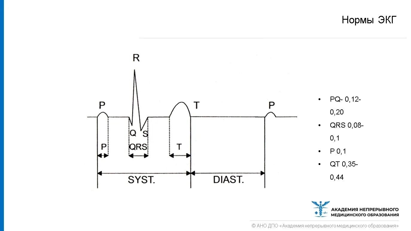 QRS норма ЭКГ. Интервал GTS на ЭКГ норма. ЭКГ сердца QRS норма. Норма комплекса QRS на ЭКГ У взрослых.