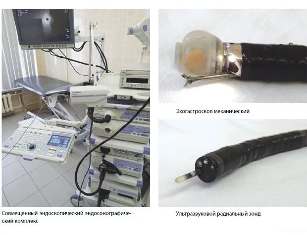 Эндосонография(ЭНДОУЗИ). Эндоскопическая ультрасонография (ЭУС). Эндоскопическое ультразвуковое исследование поджелудочной железы. Эус желудка