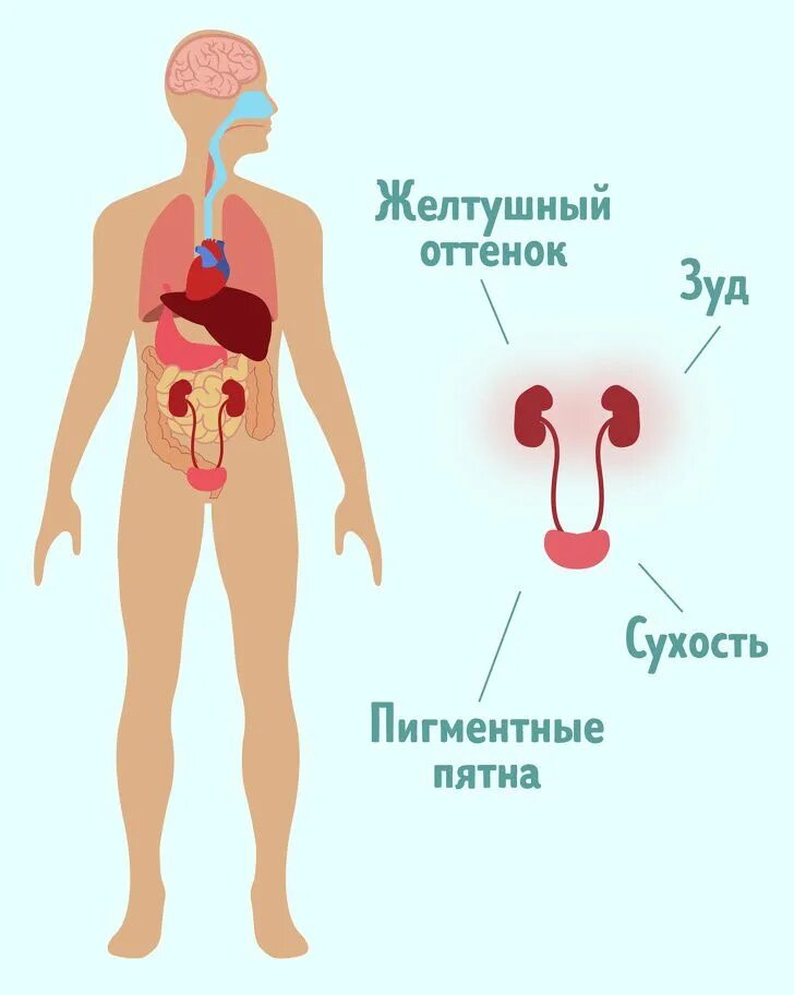 Проблемы с почками симптомы. Признаки проблем с почками.