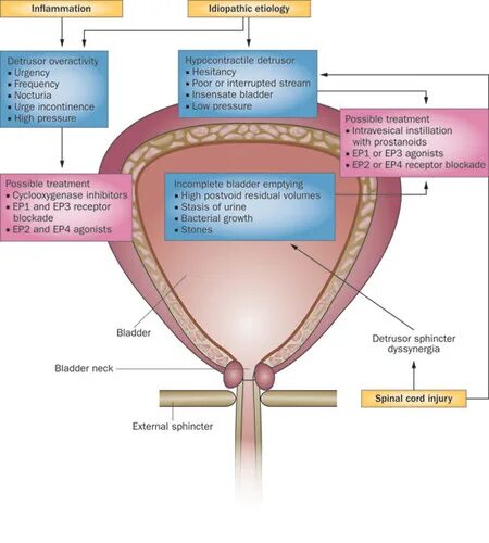 Детрузора мочевого пузыря. Детрузор мочевого пузыря у мужчин. Детрузор и сфинктер мочевого пузыря. Детрузор мочевого пузыря образован:.