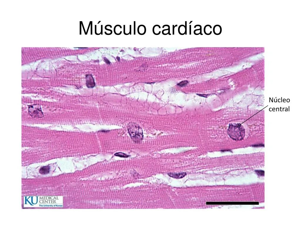Сердечная ткань миокарда. Поперечно полосатая мышечная ткань гистология. миоциты гистология. кардиомиоциты гистология. мышечная ткань гистология препараты.