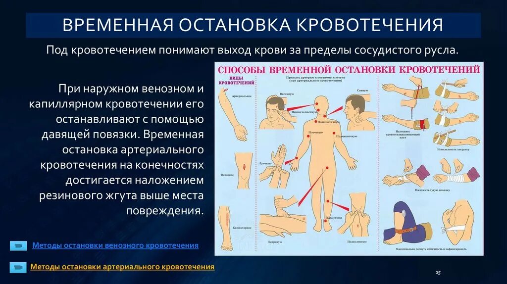 Пути остановки кровотечений. Способы остановки (временной остановки) наружного кровотечения. Временные способы остановки таблица. Методика остановки кровотечения. Кровотечение методы остановки кровотечения.