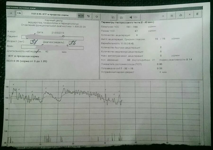 КТГ ПСП норма 36 недель. КТГ плода норма 36 неделе беременности. STV на КТГ норма 36 недель. Норма шевелений плода на КТГ на 36 неделе.