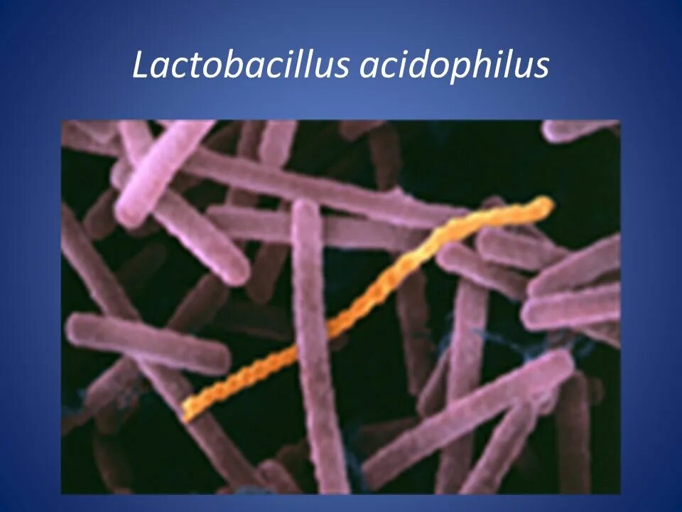 Палочка бифидобактерии. Лактобациллы ацидофильные. Lactobacillus Acidophilus (ацидофильная палочка). Ацидофильные лактобактерии (Lactobacillus Acidophilus). Lactobacillus Acidophilus под микроскопом.