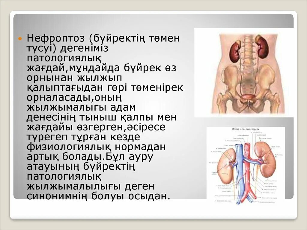 Нефроптоз почки слева. Нефроптоз 1 степени узи. пальпация почки при нефроптозе.
