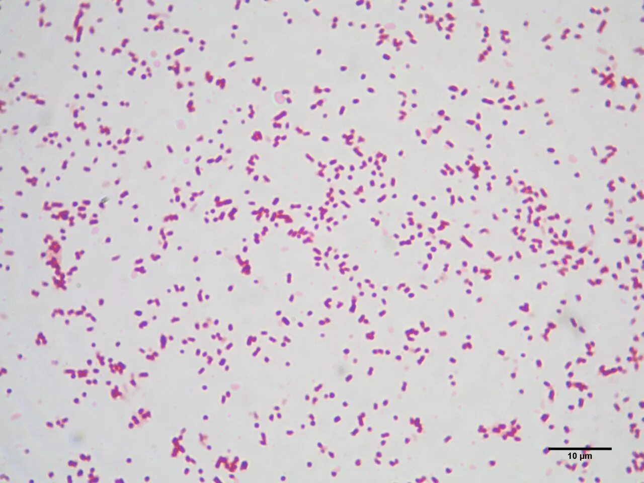 Spp salmonella spp shigella spp. Сальмонелла тифи микроскопия. salmonella spp микроскопия. salmonella enteritidis микробиология. сальмонелла энтеритидис морфология.