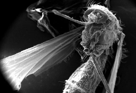 Снег под микроскопом для детей микробы Retratos de microbios al microscopio  Microscope electronique, Micro