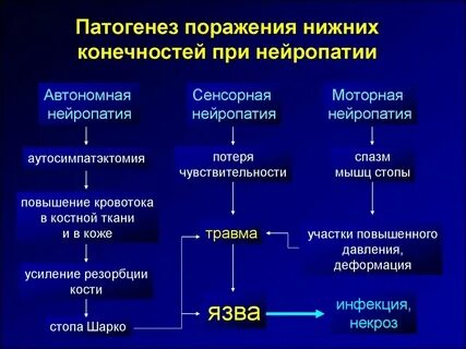Полинейропатия ног