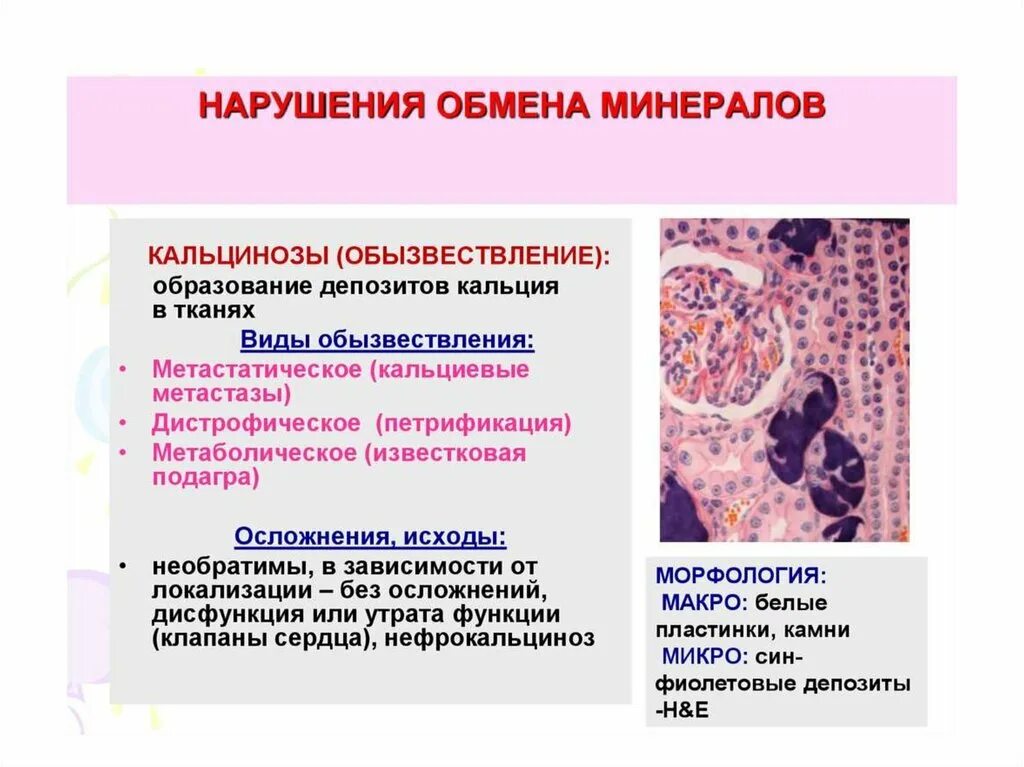 Нарушения кальция в организме. Нарушение обмена кальция патанатомия. виды обызвествления. кальциноз патологическая анатомия.