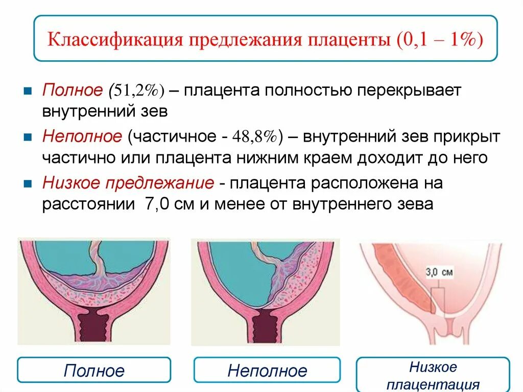 Нижний край плаценты у края внутреннего зева плаценты. Нижний край плаценты у края внутреннего зева что это. Низкая плацентация критерии. Классификация предлежания плаценты, краевое. Шейка в 12 недель