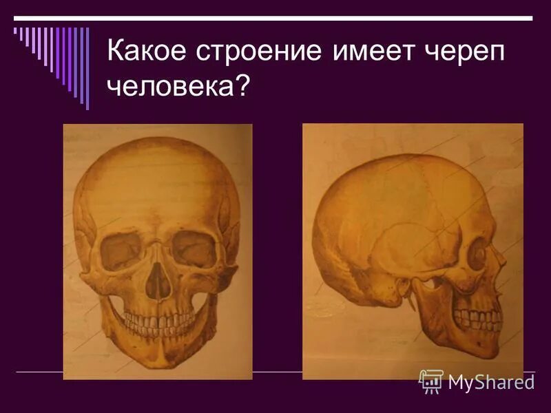 Нормальная форма черепа. Какую форму имеет череп. Типовые особенности черепа. Парные кости лицевого отдела черепа. Какую форму имеет череп.