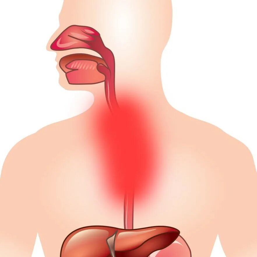 Боли в горле и пищеводе