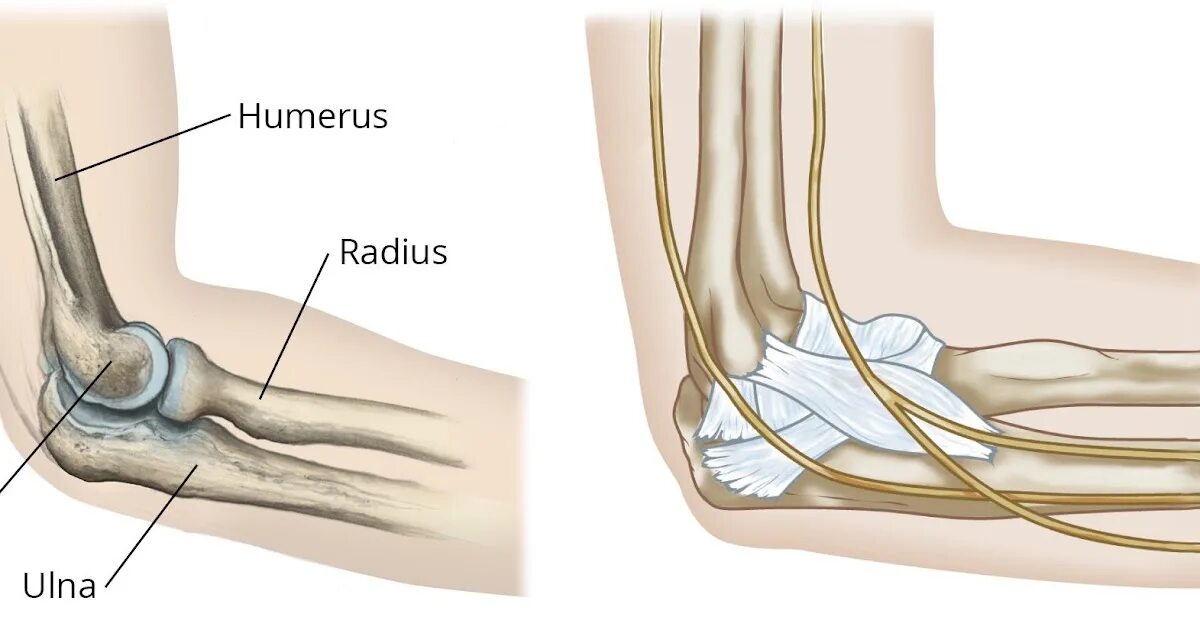 Бурса локтевого сустава анатомия. Синовиальные сумки локтевого сустава. Олекранон локтевой кости. Перелом локтевого отростка.