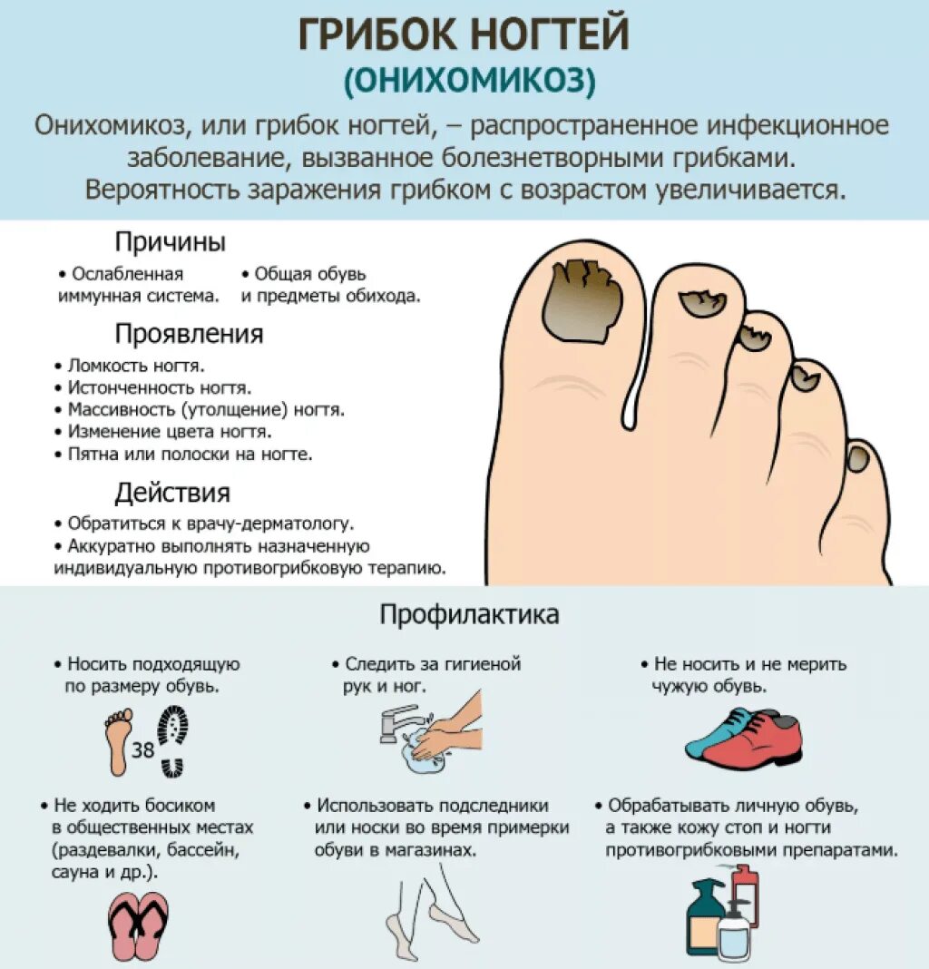 Для предотвращения грибковых заболеваний клубни. Грибок ногтей онихомикоз. Грибковое поражение ногтей на ногах. Как лечить грибок на ногтях на ногах. Признаки грибка ногтей на ногах.