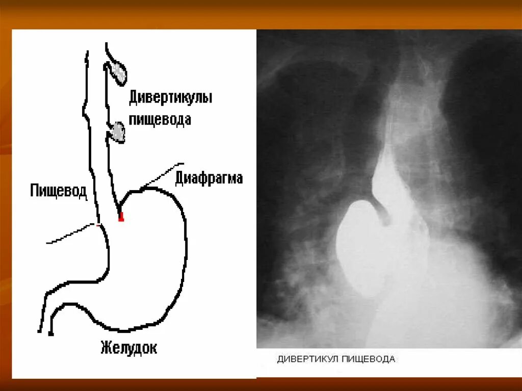 Форма пищевода