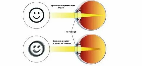 Точки на ореолах